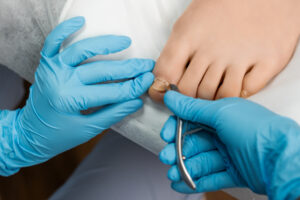 Image to accompany blog - Top Tips for Troublesome Toenails